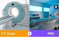 Biaya CT Scan dan MRI